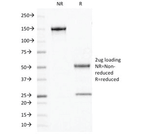 OLIG2 Antibody (clone OLIG2/2400)