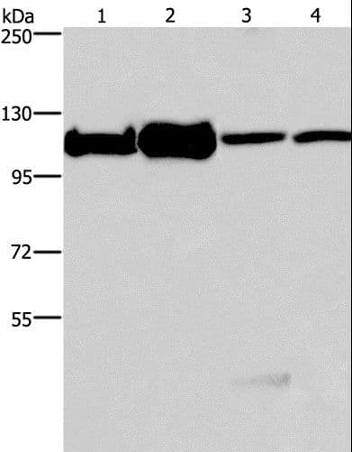 Polyclonal Rabbit anti-Human MCM6 Antibody (IHC, WB)