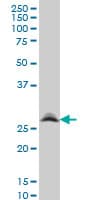 RNF141 Antibody (clone 6D9)