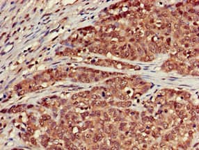 Polyclonal Rabbit anti-Human SCTR / SR / Secretin Receptor Antibody (IHC, IF)