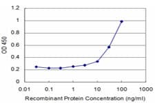 IHC-plus™ SMAD6 Antibody (clone 2A6)