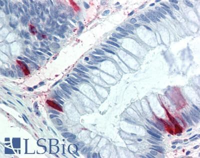 Polyclonal Rabbit anti-Rat Peptide YY / PYY Antibody (aa30-98, IHC, WB)