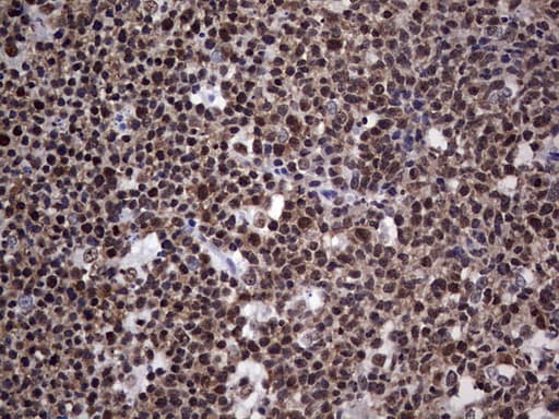 Monoclonal Mouse anti-Human PPP1R8 / Rnase E Antibody (clone OTI4E5, aa1-225, IHC, WB)