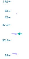 Human S100P Protein (Recombinant GST)