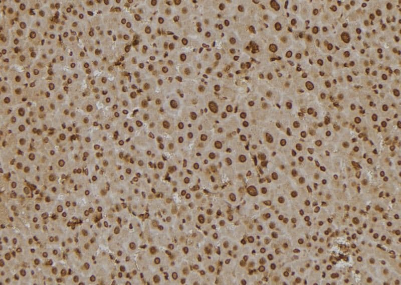 Polyclonal Rabbit anti-Human SCCPDH Antibody (IHC, WB)