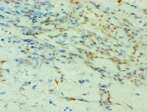 SMYD3 Antibody (aa199-428)
