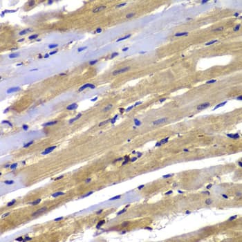 FAK / Focal Adhesion Kinase Antibody