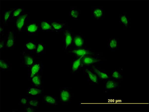 API5 Antibody (clone 1C2)