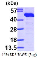 Human ERP44 Protein (Recombinant His)