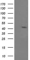 MAPK9 / JNK2 Antibody (clone OTI1A1)
