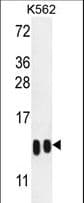 Histone H4 Antibody (aa1-30)