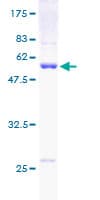 Human PSMA7 Protein (Recombinant GST)