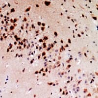 IL13 Antibody