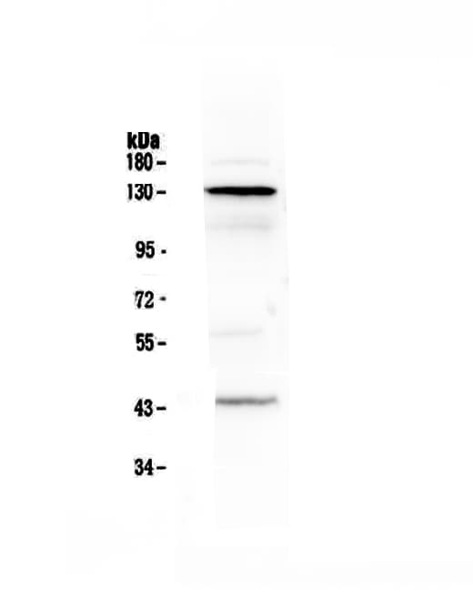 Polyclonal Rabbit anti-Human CD144 / CDH5 / VE Cadherin Antibody (WB)