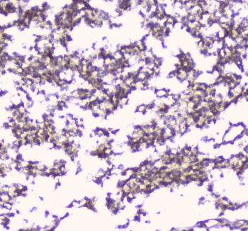 ERGIC-53 / LMAN1 Antibody