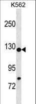 HIRA Antibody (aa32-61)
