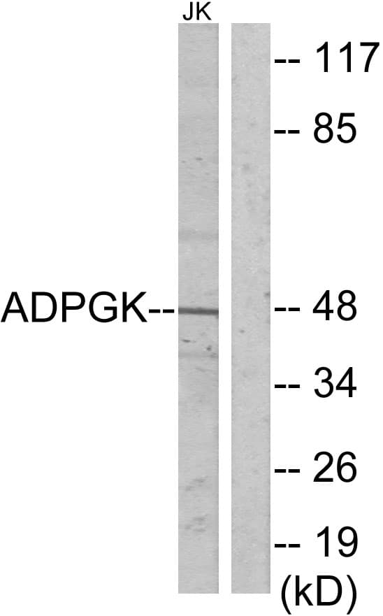 ADPGK Antibody (aa241-290)