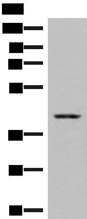 Polyclonal Rabbit anti-Human DHPS Antibody (IHC, WB)