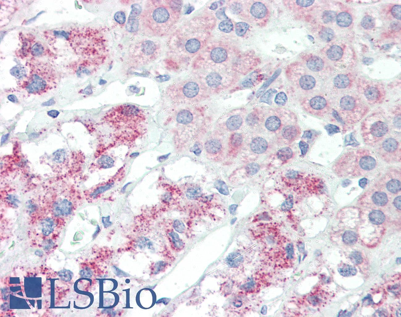 IHC-plus™ SLITRK6 Antibody