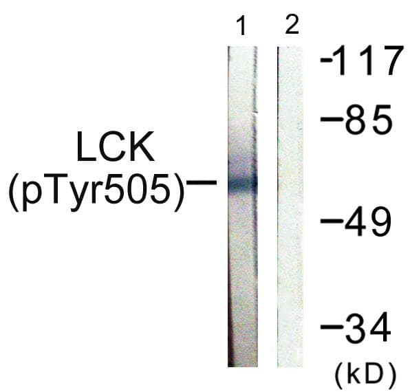 Polyclonal Rabbit anti-Human p56lck / LCK Antibody (phospho-Tyr505, IHC, WB)