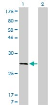 CAPNS1 / CAPN4 Antibody (clone 3C4)