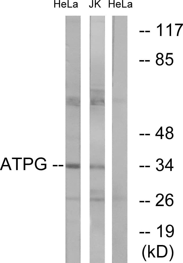 ATP5C1 Antibody (aa131-180)