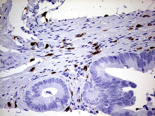 Monoclonal Mouse anti-Human S100A9 / MRP14 Antibody (clone UMAB173, Carrier-free, IHC, IF, WB)