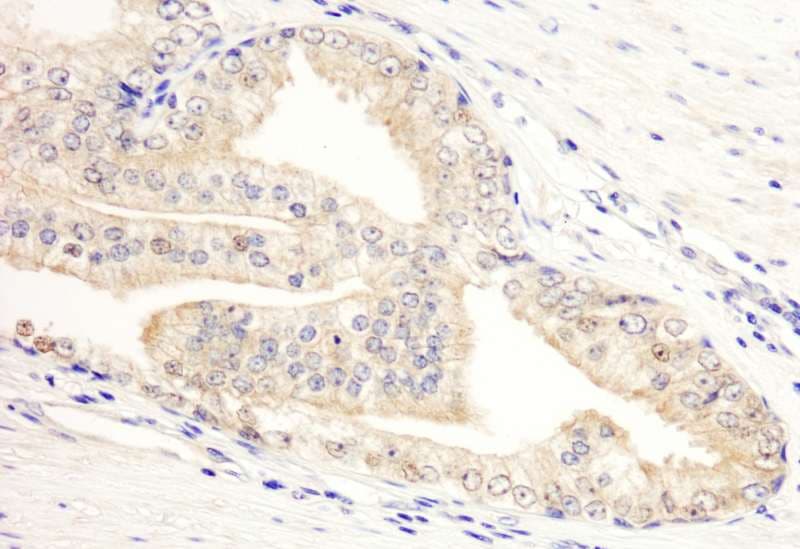 Polyclonal Rabbit anti-Human KANK2 Antibody (aa550-600, IHC, WB)