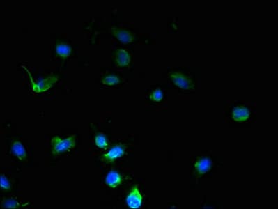 SSMEM1 / C7orf45 Antibody