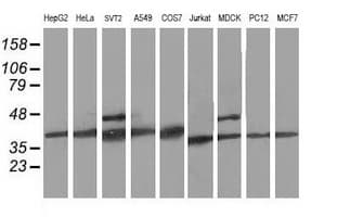 Monoclonal Mouse anti-Human CDK2 Antibody (clone OTI2D9, IHC, IF, WB)