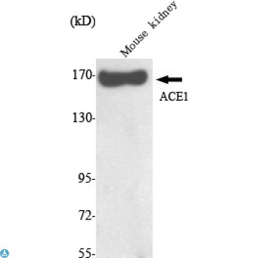 ACE / CD143 Antibody