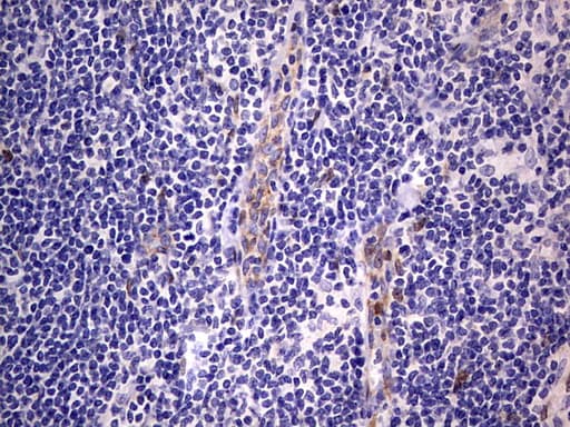PRX-1 / PRRX1 Antibody (clone OTI1E10)
