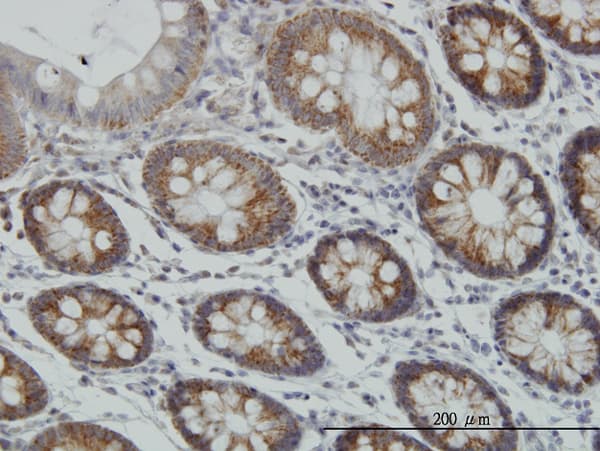 MCAT Antibody (clone 2F2)