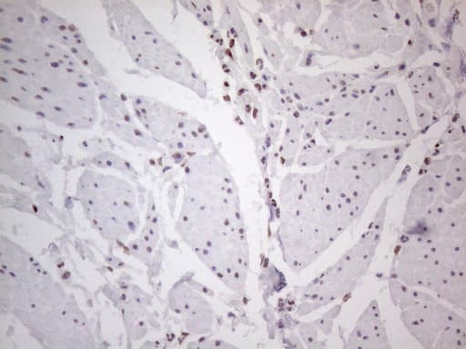 Monoclonal Mouse anti-Human HNRNPL / hnRNP L Antibody (clone OTI4E5, aa270-502, IHC)