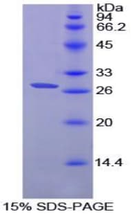 Mouse CX3CL1 / Fractalkine Protein (Recombinant His)