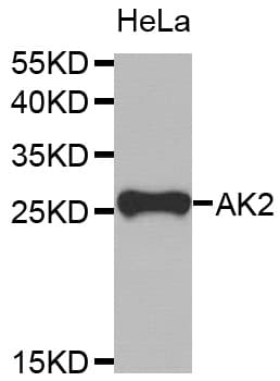 Polyclonal Rabbit anti-Human AK2 / Adenylate Kinase 2 Antibody (IHC, WB)