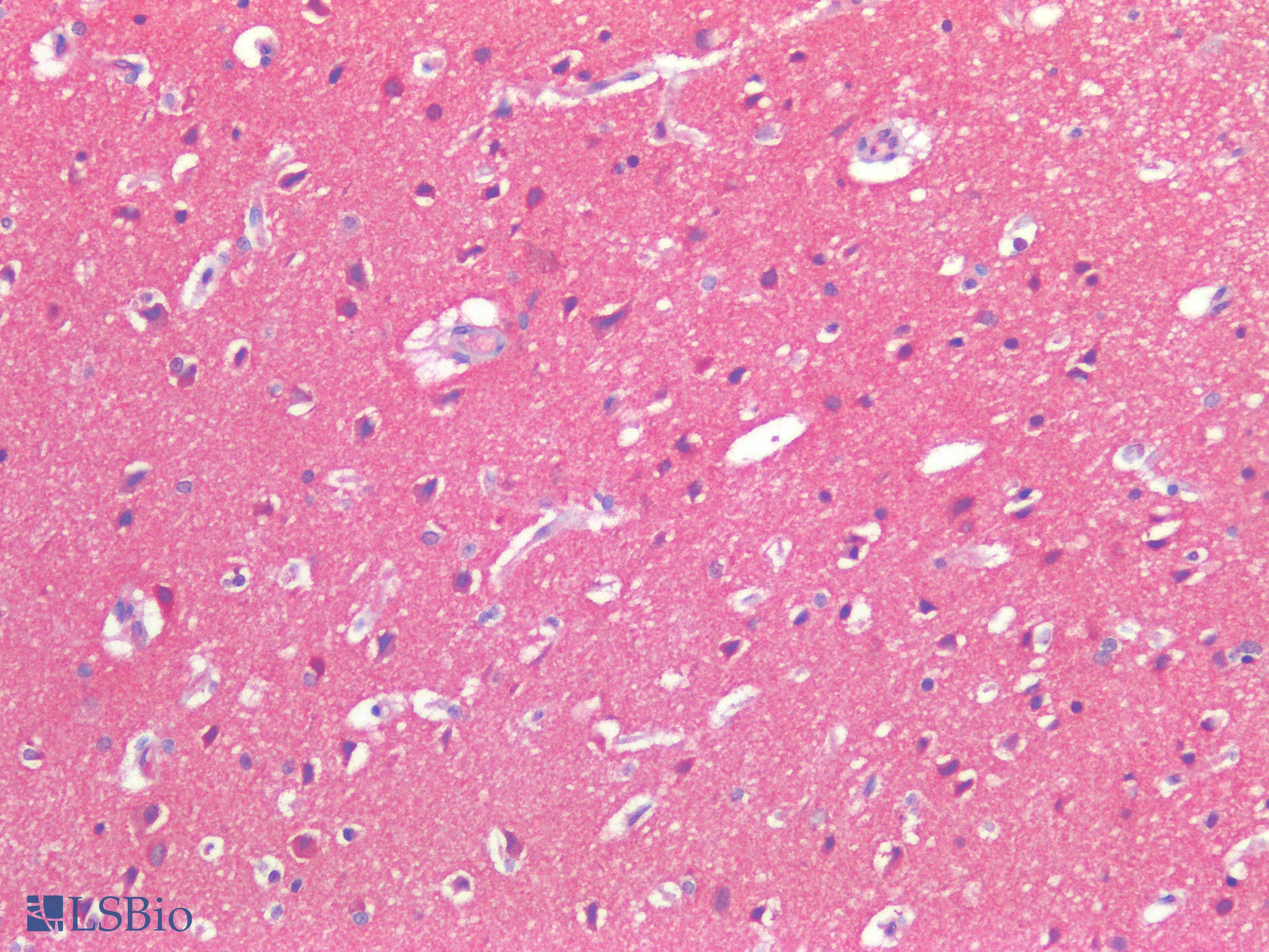 PathPlus™ Polyclonal Rabbit anti-Human CD276 / B7-H3 Antibody (IHC)