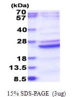 Human B9D2 Protein (Recombinant His)
