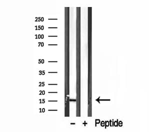 Polyclonal Rabbit anti-Human E-FABP / FABP5 Antibody (IHC, WB)