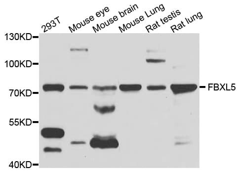 FBXL5 / FBL5 Antibody