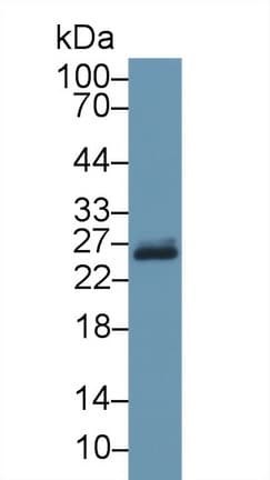 GSTP1 / GST Pi Antibody (aa1-210)