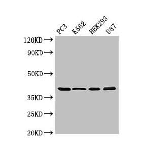 SLAMF1 / SLAM / CD150 Antibody