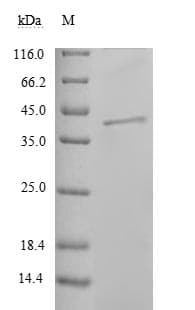 Reston Ebolavirus Nucleocapsid Protein (Recombinant 6His, N-terminus)