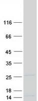 Human NDUFS4 Protein (Recombinant Myc-DDK (Flag))