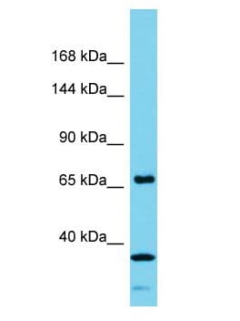 Polyclonal Rabbit anti-Human ANKRD62 Antibody (aa551-600, WB)