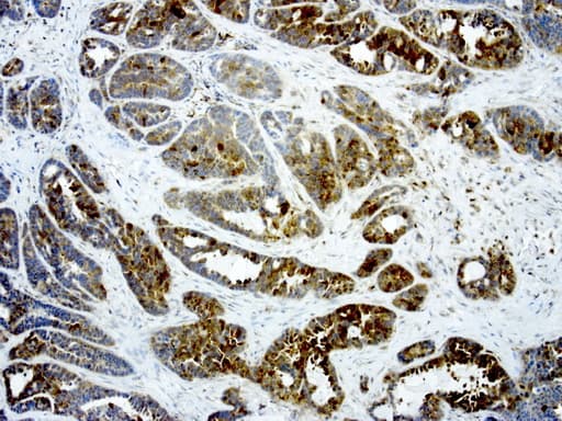 LGALS3 / Galectin 3 Antibody (clone UMAB189, Carrier-free)