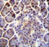 PTCHD4 / C6orf138 Antibody (aa563-591)