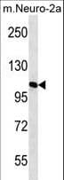 IHC-plus™ MAN2A2 / Alpha-Mannosidase II Antibody (aa767-796)