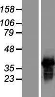 SFRS7 / 9G8 Protein (Over-Expression Lysate Myc-DDK (Flag))
