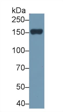 PLCB2 Antibody (PE)